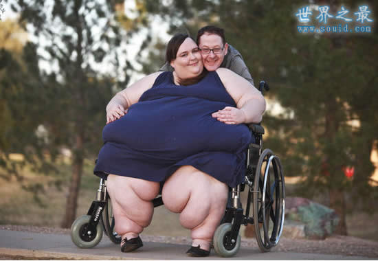 世界第一胖人，苏珊娜.埃曼重达1450斤(图片)