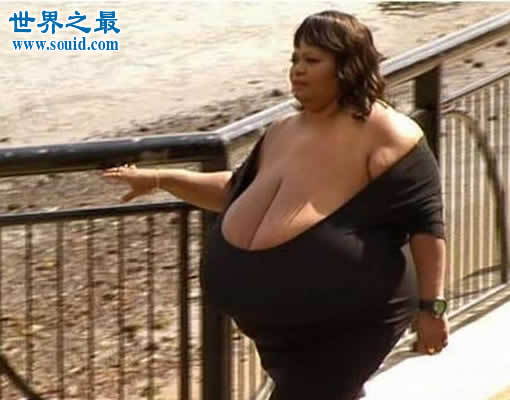 关于女人胸部的10个世界之最，最大的乳房重77斤