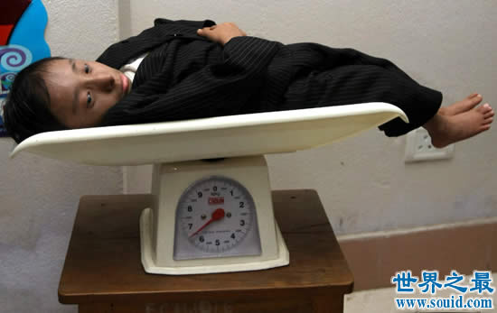 世界上体重最轻的人，18岁少年体重仅11斤(图)